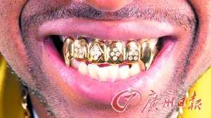 2013年热门网络热词土豪还有他们的特点,太奇葩(图)